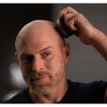 MicroTouch Head Shaver    thumbnail