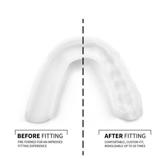 Custom-Fit Dental Night Mouth Guard
